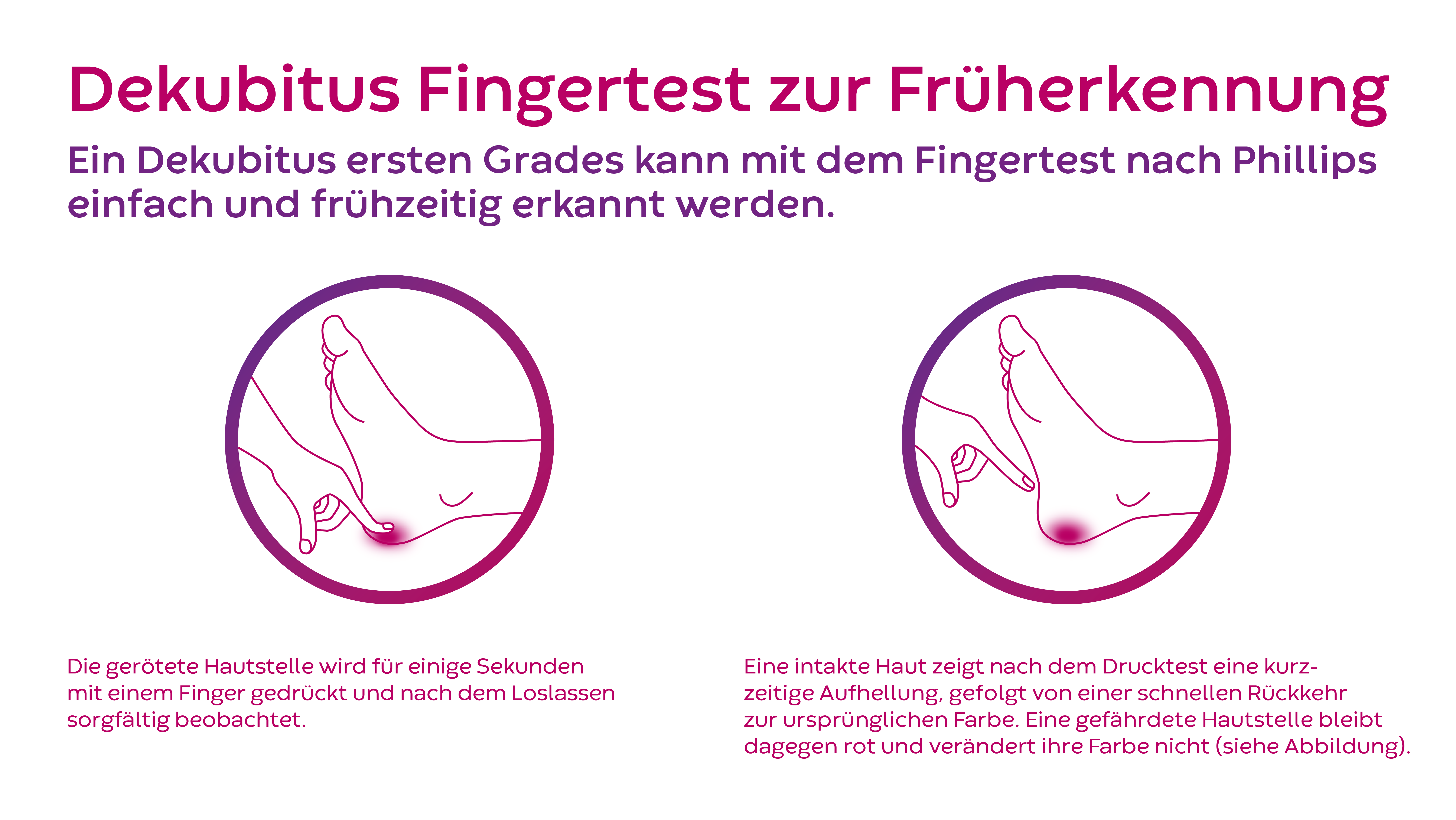 Dekubitus Test zur Fr&uuml;herkennung nach Philips