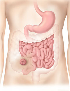 a stomach