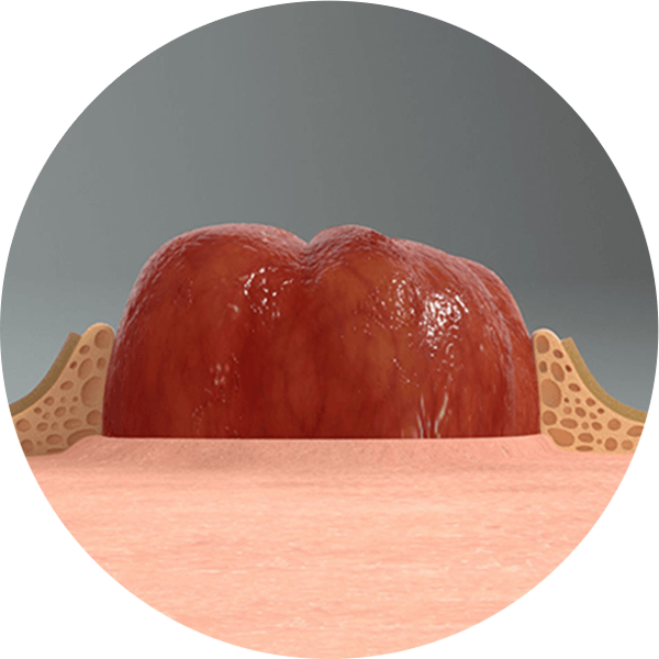 detail systému LEAK-LOCK™